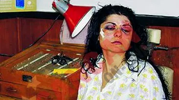 Si-a scos singura ochiul!