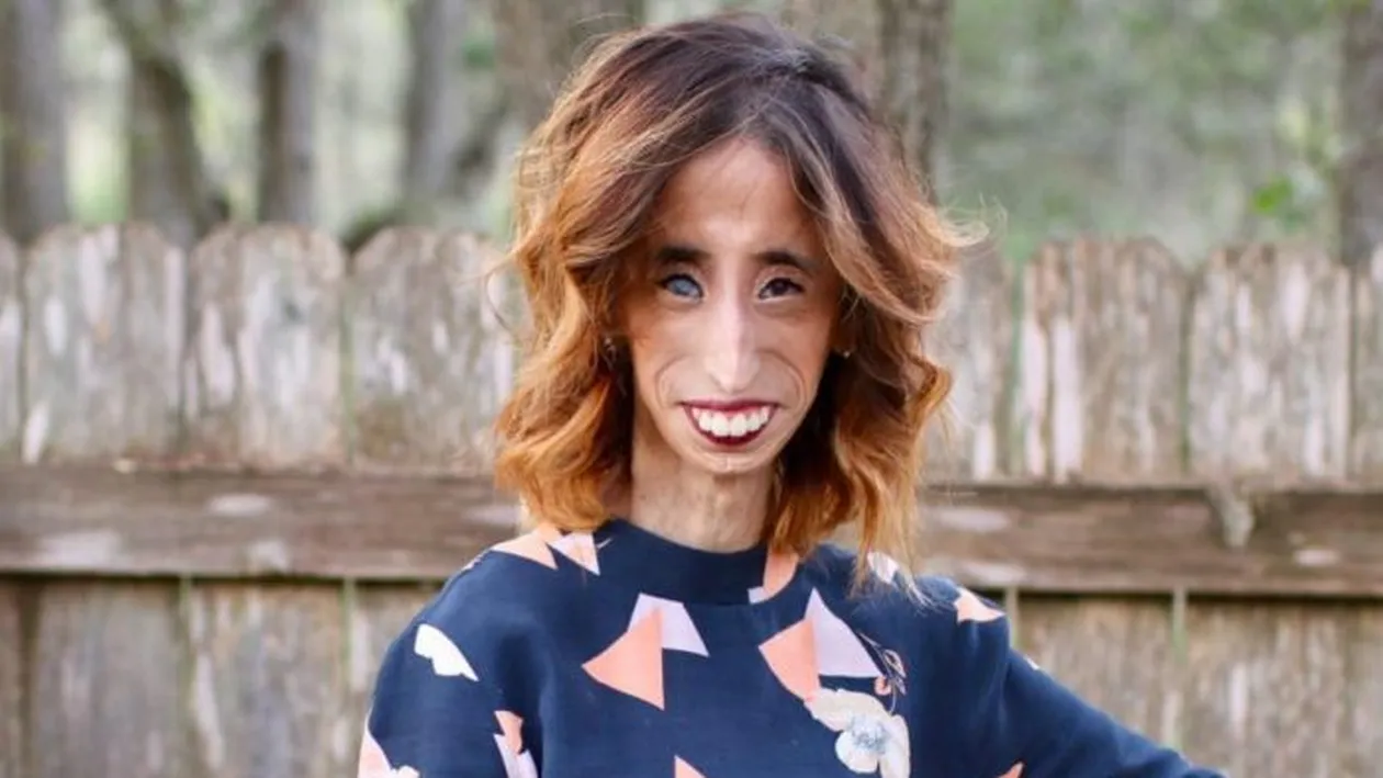 A fost catalogată “cea mai urâtă femeie din lume”, iar acum... Cum arată, în prezent, Lizzie Velasquez