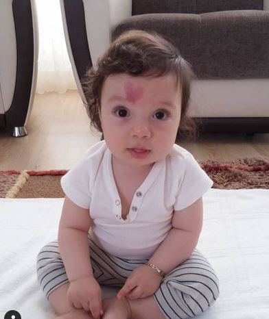 Cazul care a uimit medicii. O femeie a născut un bebeluș cu o inimă în frunte. Cum arată băiețelul acum, la 6 ani