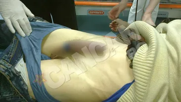 Un moldovean a ramas cu penisul blocat intr-o sticla! A incercat placeri interzise!