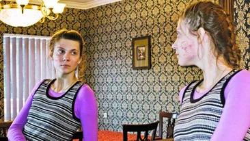 Alterarea imaginii il face sa gandeasca negativ! Ajutoor! Adolescentul meu are acnee si e tot timpul deprimat