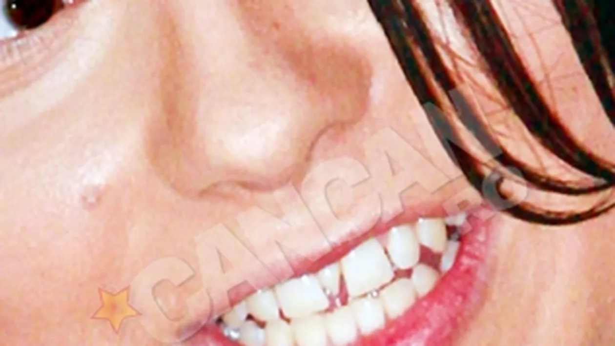 Inna a stat cu un dintisor in plus pana sa fie vedeta