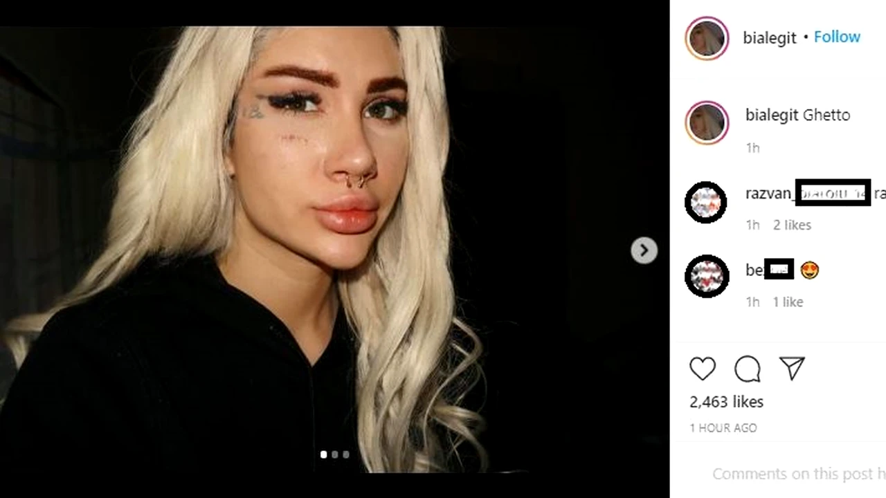 Bia Khalifa s-a pozat în timp ce îi curge sânge din nas. Controversata  artistă, criticată dur pe Instagram: “Când dai la m#*$ cu nasul, asta se  întâmplă”