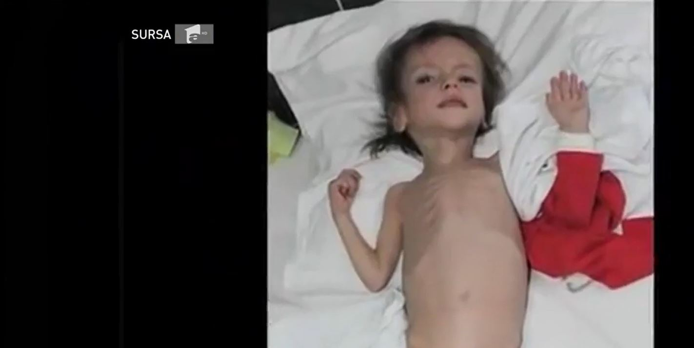 Ce frumoasă este Flori, fetița care a fost hrănită doar cu pufuleți și ceai! Recent, părinții adoptivi i-au arătatpozele când era într-o stare critică: “A început să plângă…”