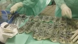 O femeie a înghiţit 7.000 de dolari! Motivul pentru care a recurs la acest gest şocant