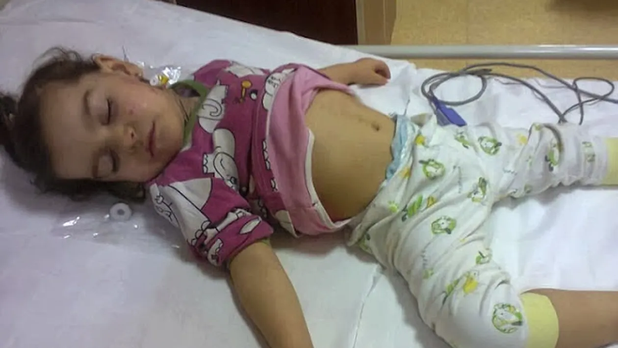 Se lupta cu moartea la numai patru ani! Vezi aici cazul tragic al fetitei care nu poate manca decat lichide!