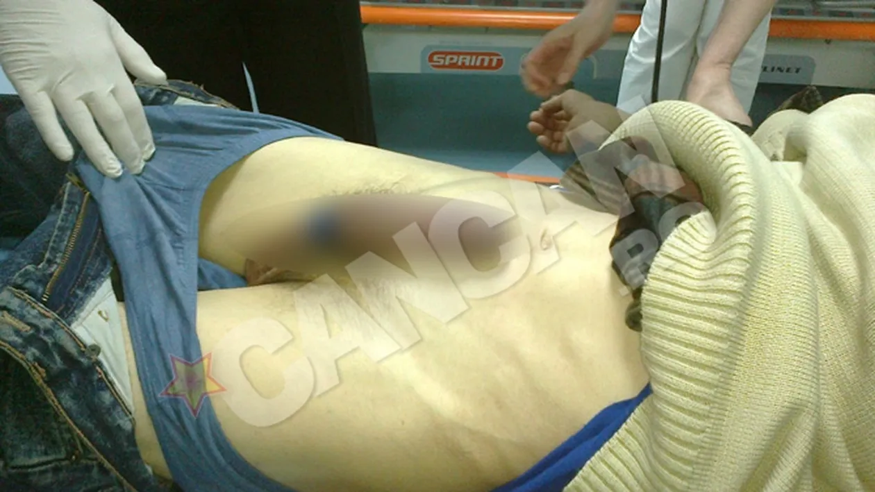 Un moldovean a ramas cu penisul blocat intr-o sticla! A incercat placeri interzise!