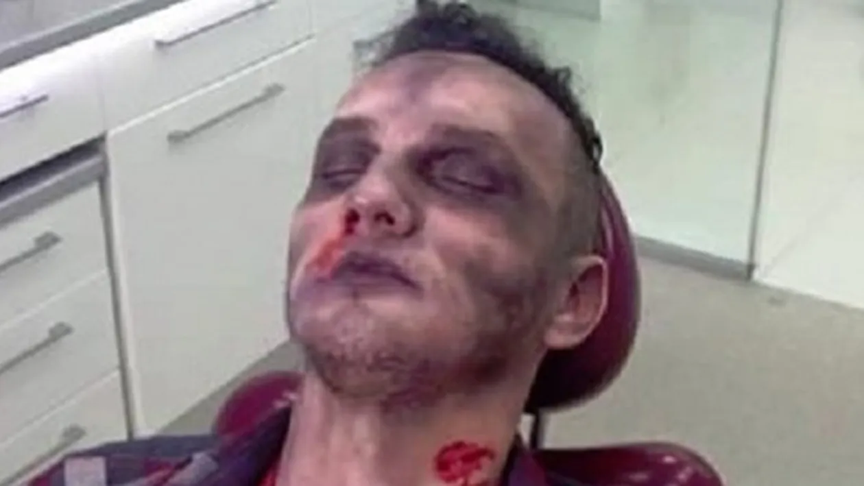 Mihai Trăistariu şochează din nou! Vezi fotografia care te înspăimântă:''M-am speriat, parcă eşti mort''