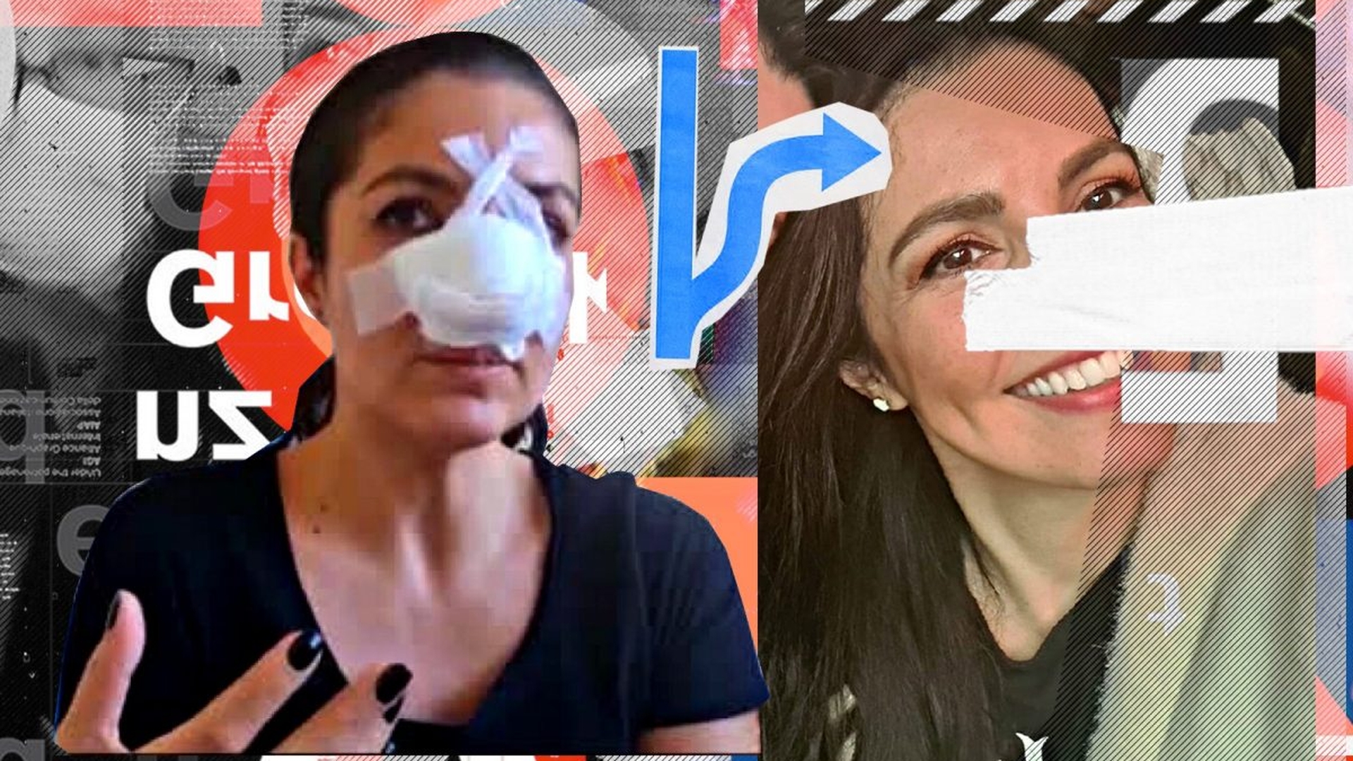 Cristina Joia, prima poză fără mască după operațiile suferite la nas din cauza loviturilor încasate de la agresoarea sa: “Sunt puțin «pirată». Îmi asum nasul ăsta brăzdat”