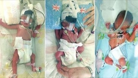 INCREDIBIL! O femeie a născut de două ori în şapte zile. Băiatul a fost ceva mai grăbit decât cele două surori