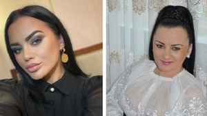 Care este prima intervenție estetică la care a apelat Carmen de la Sălciua. Nimeni nu a știut până acum!