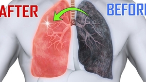 Alimentul care curăță plămânii. Efectele se simt foarte repede