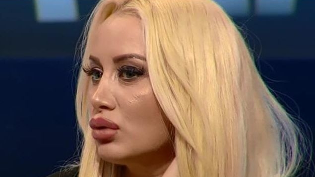 Simona Traşcă vrea să-şi opereze toată faţa: „Cu intervenţia asta lumea o să-mi dea 18-19 ani!”