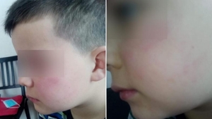 Un băiețel de 7 ani a fost bătut de tatăl unei colege. Micuțul refuză să mai meargă la școală