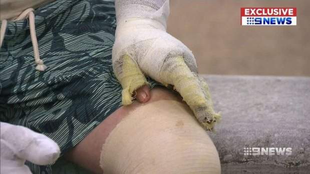 S-a aruncat în flăcări ca să îşi poată salva cei doi copii! Bărbatul e considerat un erou şi a mărturisit cu ochii în lacrimi ce s-a întâmplat cu micuţii: „Am greşit…”