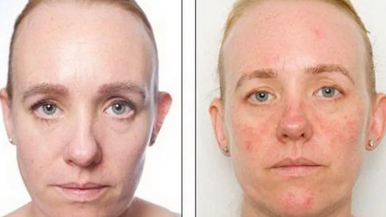 Ingrozitor! Tenul acestei femei a imbatranit cu 10 ani in doar 30 de zile! Ce a facut pentru a ajunge asa