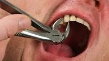 Eugen a murit după ce şi-a scos singur doi dinţi. Nu avea bani să meargă la dentist