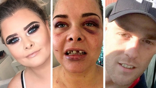 Un bărbat și-a bătut iubita și i-a spart trei dinți din cauză că a schimbat poza de pe Facebook și el nu mai apărea în ea