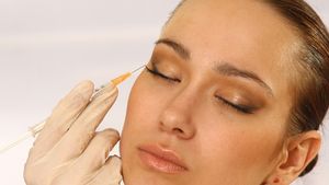 Botox-ul te scapa de riduri si de ... prieteni!
