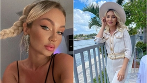 Bianca Alexandra, fosta concurentă de la „Bravo, ai stil!”, s-a accidentat grav în vacanță. Tânăra a apărut cu fața bandajată: ”Ne țin sechestrați în hotel”