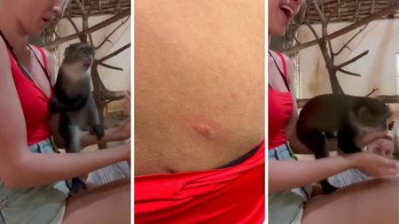 Vedeta din România care a fost mușcată de maimuțe în vacanță: „Nu am fost la doctor. Mi-a zis ChatGPT să stau liniștită”
