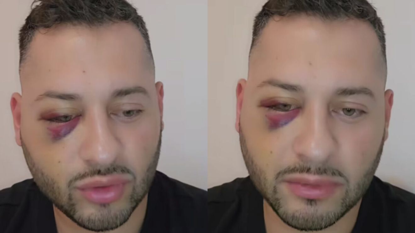 Mărturisiri crunte făcute de Daniel Balaș după episodul violent de pe litoral. Ce s-a întâmplat, de fapt, între fostul preot și bătăușii care l-au băgat în spital: ”Prostia mea a fost că...”