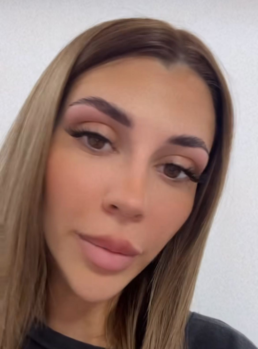 Mădălina de la Insula iubirii, intervenţie neaşteptată la nivelul feţei. Cum arată acum, după ce şi-a scos acidul din buze