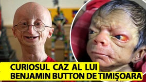 Cum arată acum singurul copil-bătrân din România, care îmbătrânește "invers". Benjamin Button de Timișoara