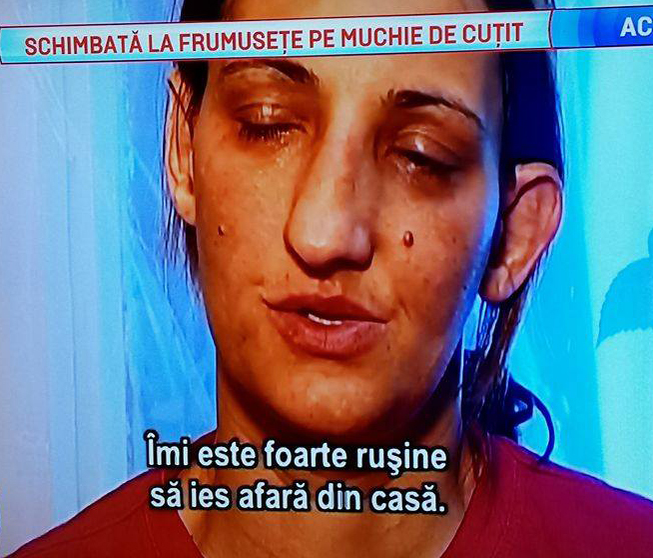 Nadia suferea mult din cauza aspectului ei fizic.