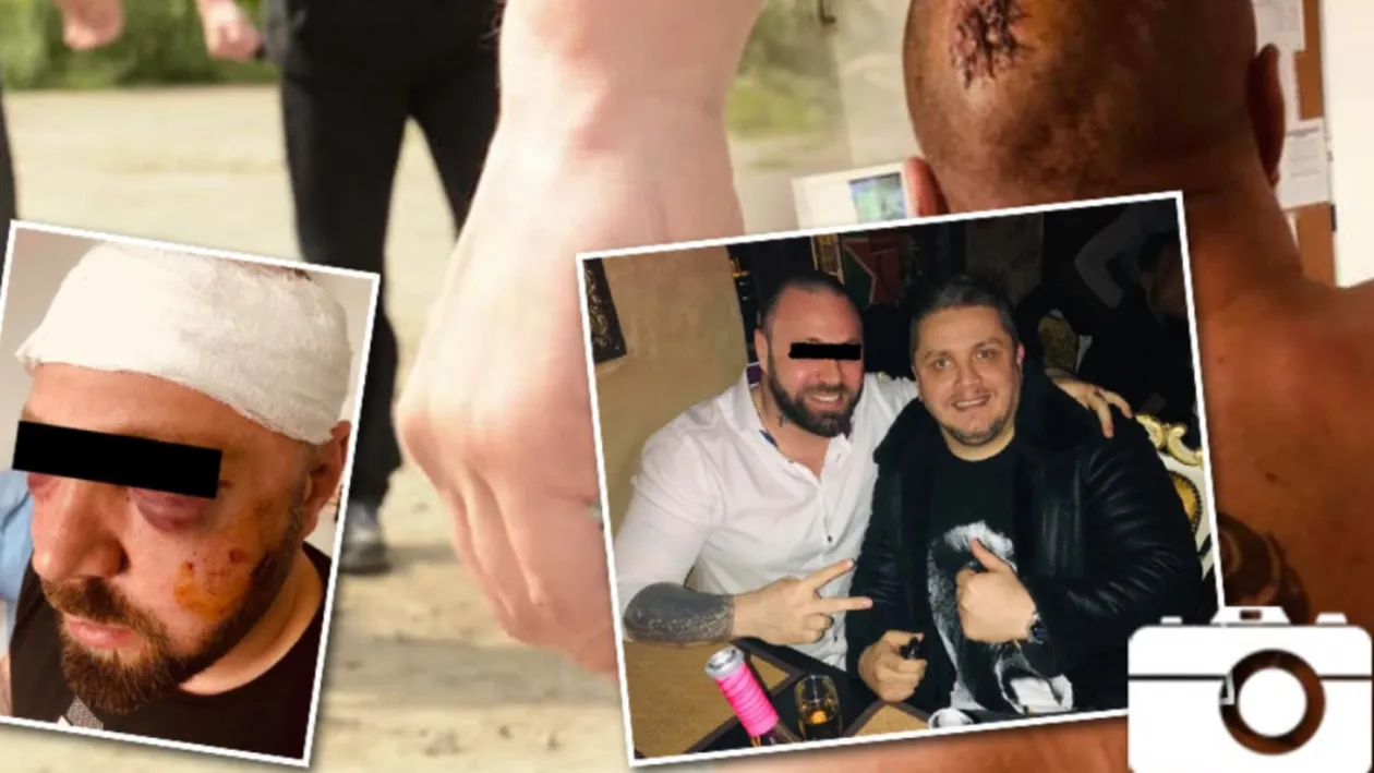 Ce a apărut pe pagina temutului interlop, la un an de când a fost snopit în bătaie: ”Am văzut moartea cu ochii...”