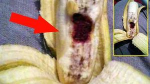 O fetiţă din Giurgiu a cumpărat banane şi când a ajuns acasă mama ei a desfăcut una şi a avut un şoc: ”Banane injectate cu sânge cu HIV”