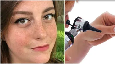 Avea dureri mari in ureche si a mers la medic abia dupa 9 zile! Cand a aflat cu ce a trait in trup atat de mult timp, femeia a simtit ca lesina. E atat de scarbos!