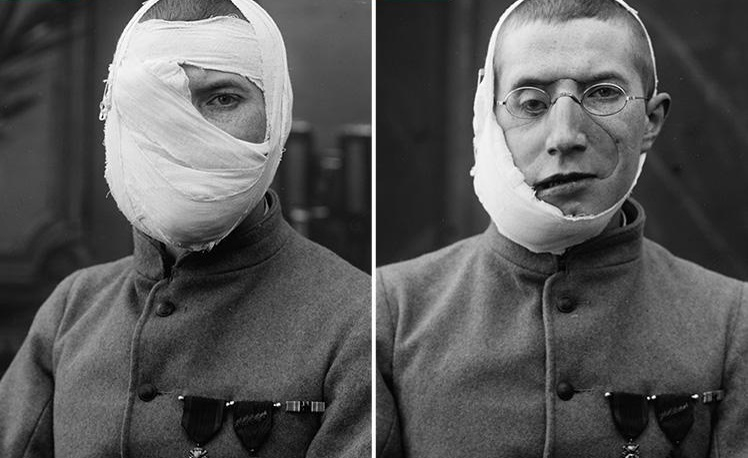 Imagini rare cu soldaţii din Primul Război Mondial! Transformarea incredibilă prin care treceau dacă erau desfiguraţi pe câmpul de luptă