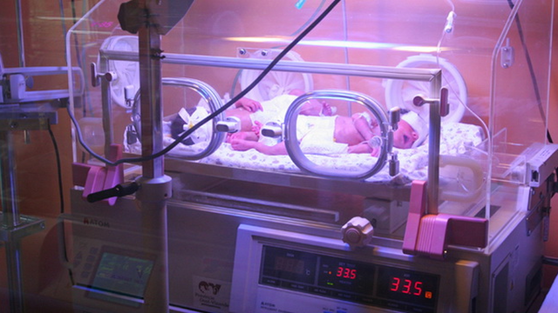 Cum arata acum copilul ars intr-un incubator in Maternitatea Bucur! Au trecut 5 ani iar cosmarul familiei Bucur continua