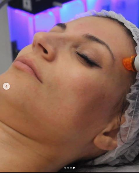 Ioana Ginghină și-a făcut o nouă intervenție estetică! Actrița a apelat la un truct folosit și de vedetele de la Hollywood