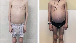 La 11 ani, e piele şi os şi are înălţimea unui copil de cinci ani. Motivul pentru care o mamă şi-a înfometat fiul şi l-a drogat