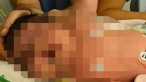 MEDICII, SOCATI! A fost un miracol ca mama a supravietuit! Afla cate kilograme a putut sa aiba un copil la nastere!