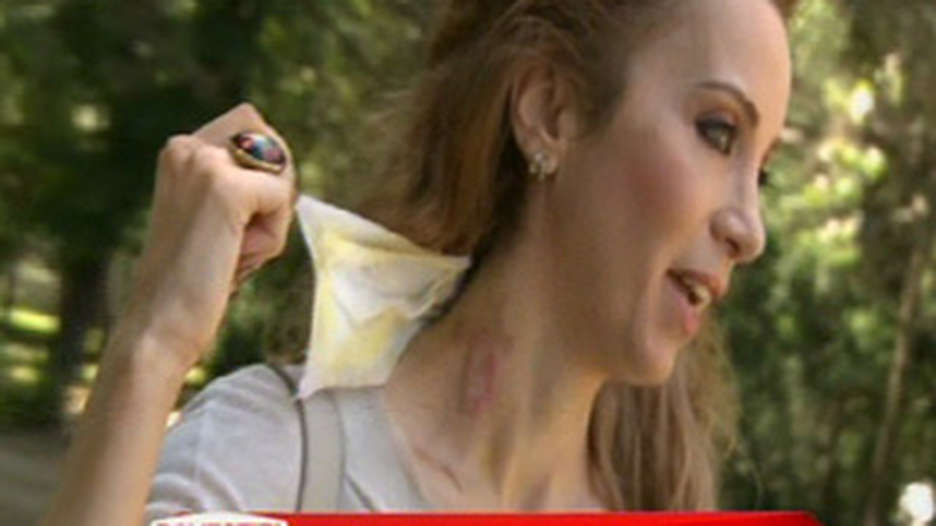 Dupa ce a fost arsa pe gat cu ondulatorul, Annes se gandeste sa-si faca un tatuaj pentru a acoperi cicatricea