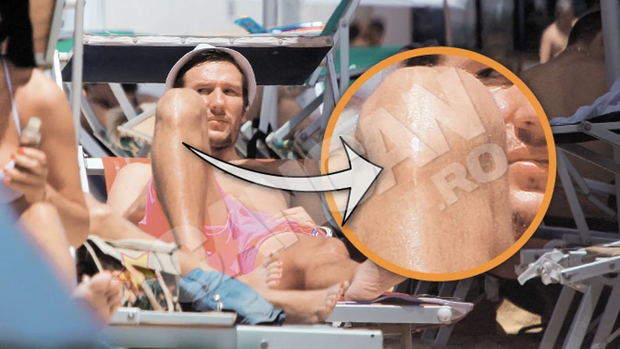 Iacob a incercat sa agate cu cicatricea de pe genunchi