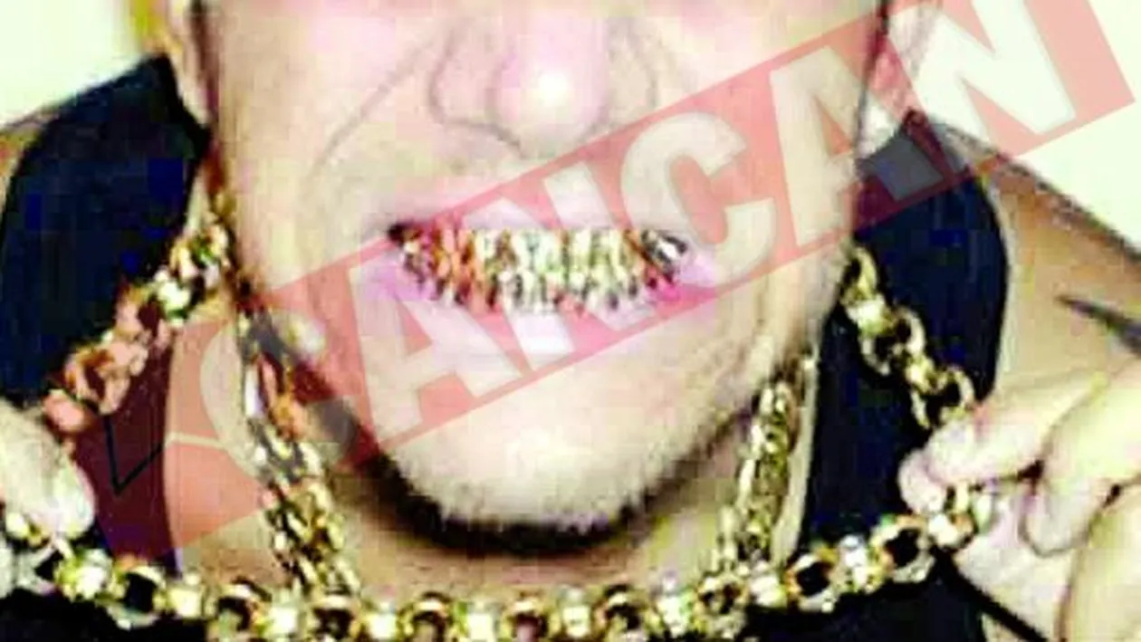 Isi vinde dantura din aur