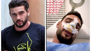 A zis că nu-și va opera nasul niciodată, dar s-a răzgândit! Cum arată Dorian „Hâtz” Popa, după ce și-a făcut rinoplastie