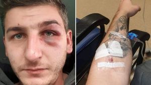 Șofer român de TIR, bătut în Spania de patronii pentru care lucra. ”I-au luat cheile de la casă, mașină, telefonul, l-au amenințat cu moartea!”