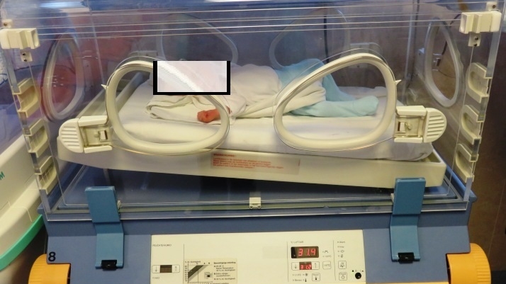 Poveste cutremurătoare! O fetiță de 12 ani din Iași a devenit mamă de gemeni! Medicii i-au dat o veste tristă despre unul dintre bebeluși