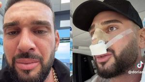 Ce probleme are Dorian Popa după operația la nas. Influencerul a recunoscut: „Nu-l simt așa încă al meu”