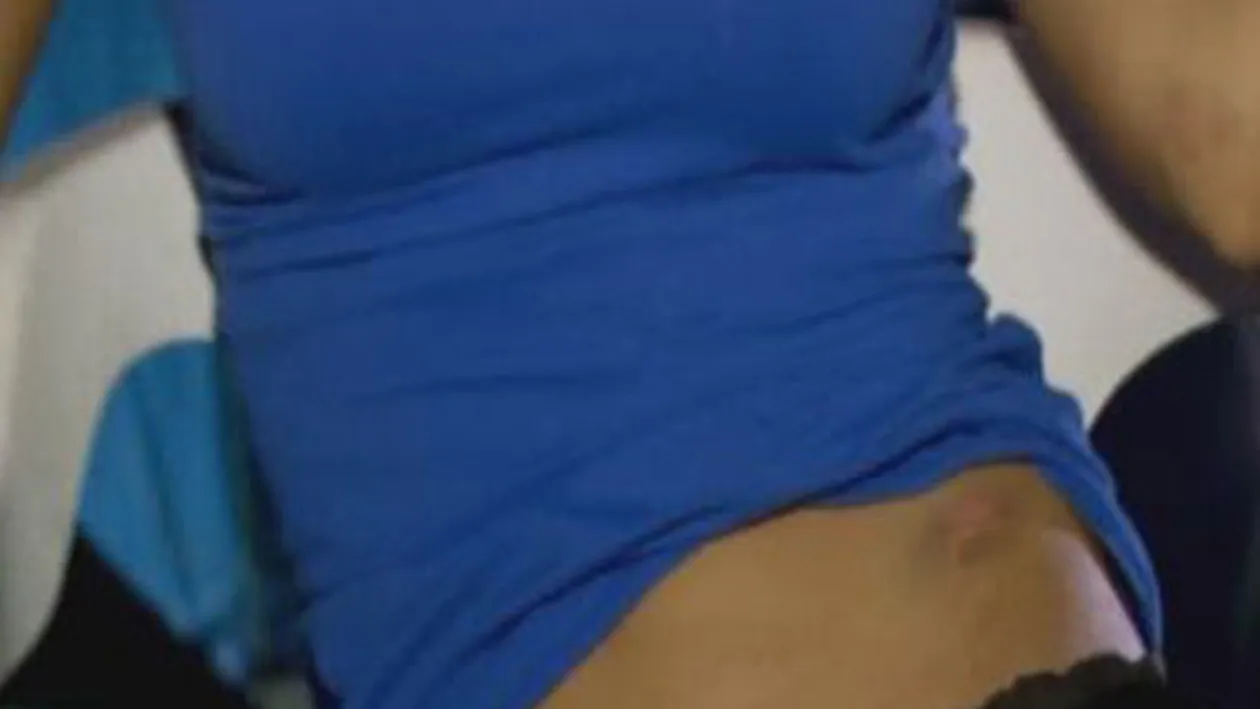 O vedeta din Romania isi arata vanataile de care e plina pe tot corpul! Afla cine e si ce i s-a intamplat!