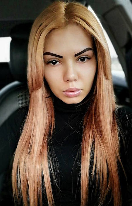 Beyonce de România, la un pas de moarte din cauza silicoanelor: „M-am trezit cu sânul învineţit, cu febră, frisoane „