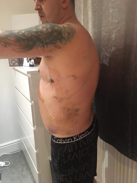 Scene de groază în Londra! Un român a fost înjunghiat în cap și lângă inimă de un grup imens de copii! A scăpat ca prin urechile acului. Atenție, imagini șocante!