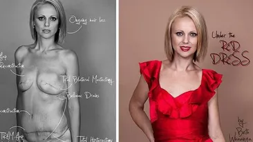 Si-a pus pe Facebook poze cu efectele devastatoare ale cancerului! Reactia INCREDIBILA a prietenilor ei