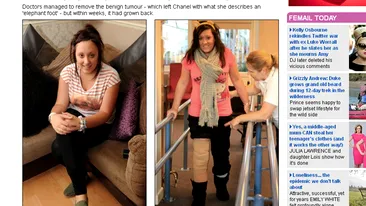 O balerina de 15 ani a acceptat sa ii fie taiat piciorul, ca sa mai poata dansa! VEZI AICI de ce