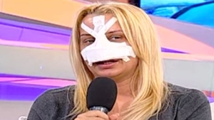 E blonda, celebra, dar asta n-o multumeste! Ea a pierdut numarul operatiilor estetice, insa noi ii tinem evidenta
